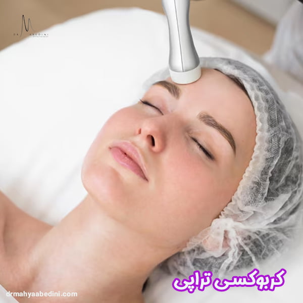 کربوکسی تراپی - دکتر محیا عابدینی