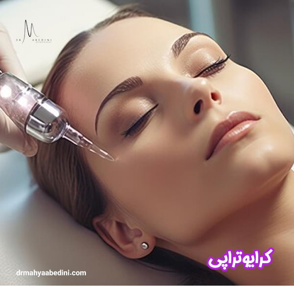 کرایوتراپی - دکتر محیا عابدینی