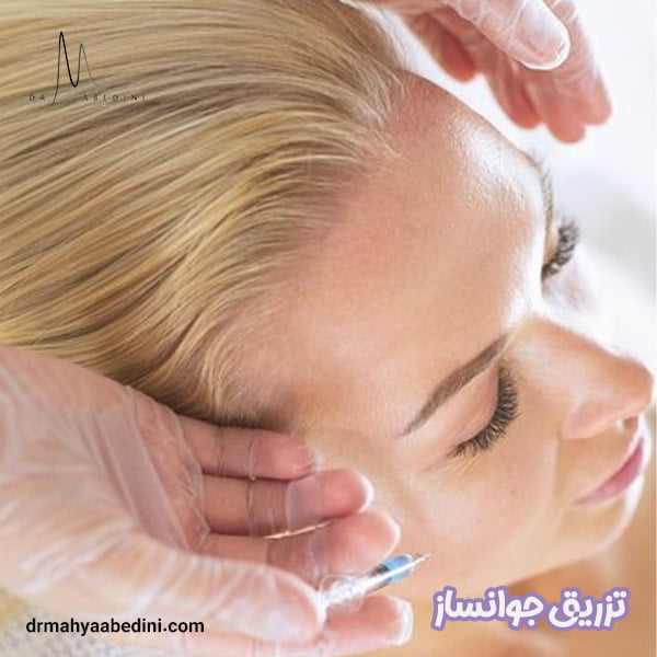 تزریق جوانساز - دکتر محیا عابدینی