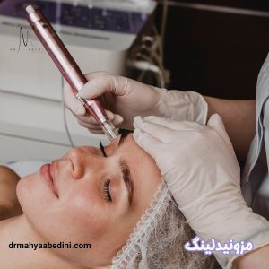 مزونیدلینگ - دکتر محیا عابدینی 