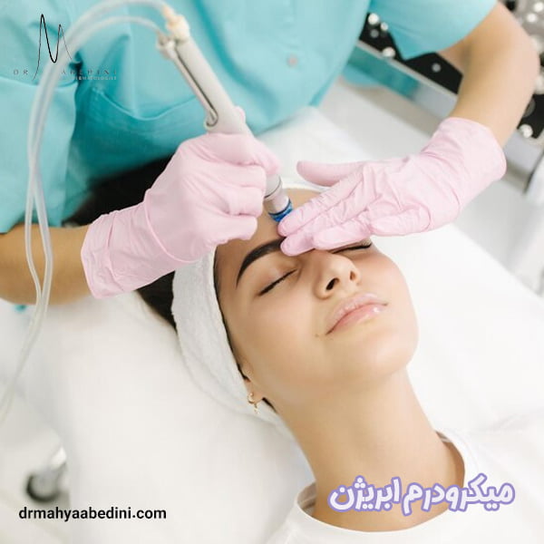 میکرودرم ابریژن - دکتر محیا عابدینی