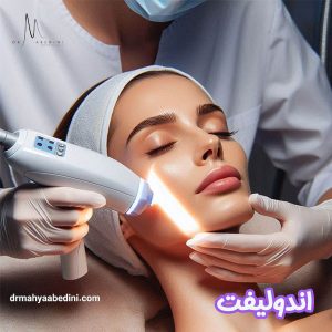 اندولیفت - دکتر محیا عابدینی 