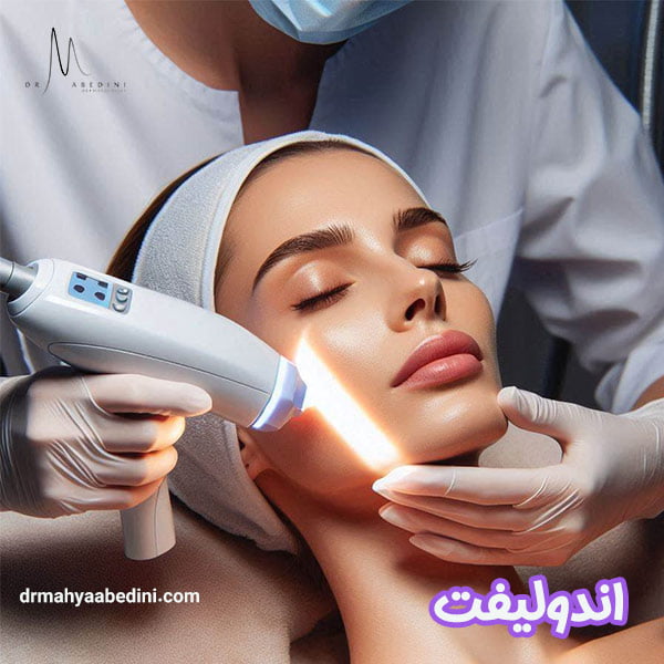 اندولیفت - دکتر محیا عابدینی