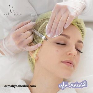 اگزوزوم تراپی - دکتر محیا عابدینی