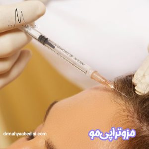 مزوتراپی مو - دکتر محیا عابدینی