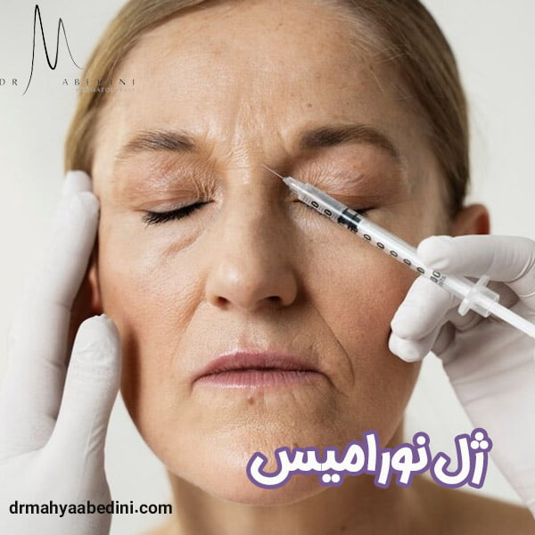 تزریق ژل نورامیس - دکتر محیا عابدینی
