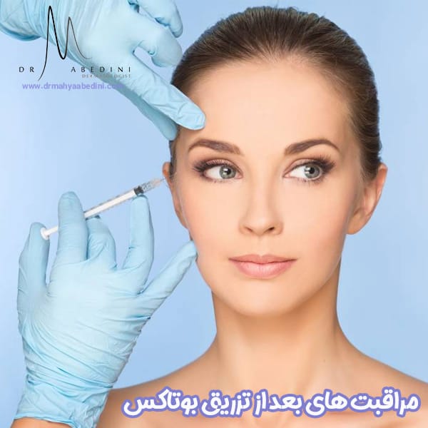 مراقبت های بعد از تزریق بوتاکس