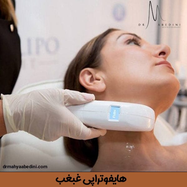 هایفوتراپی غبغب