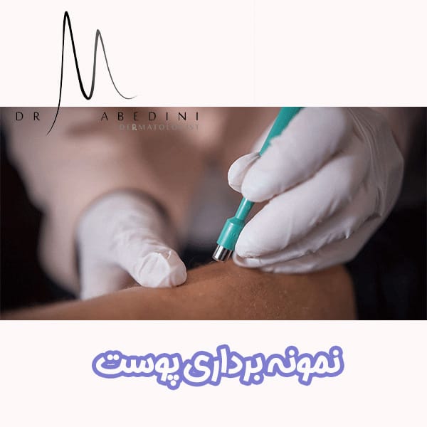 نمونه برداری پوست