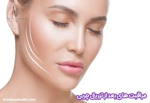 مراقبت های بعد از تزریق چربی