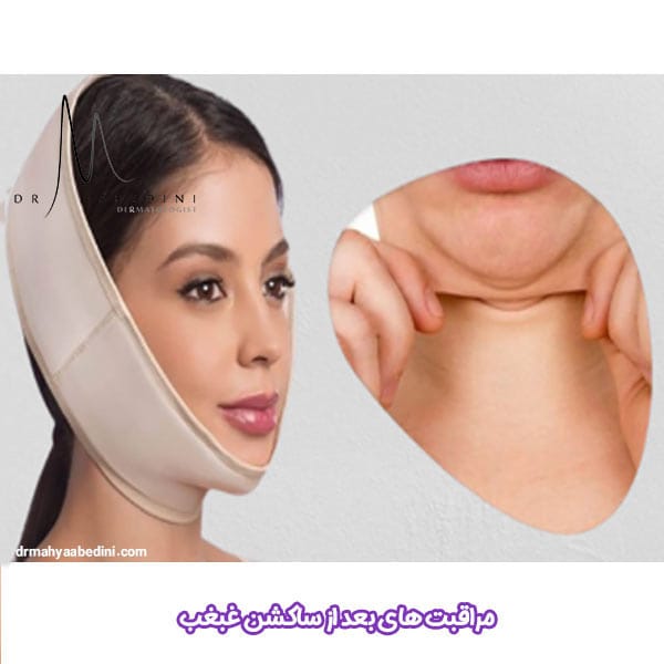 مراقبت های بعد از ساکشن غبغب