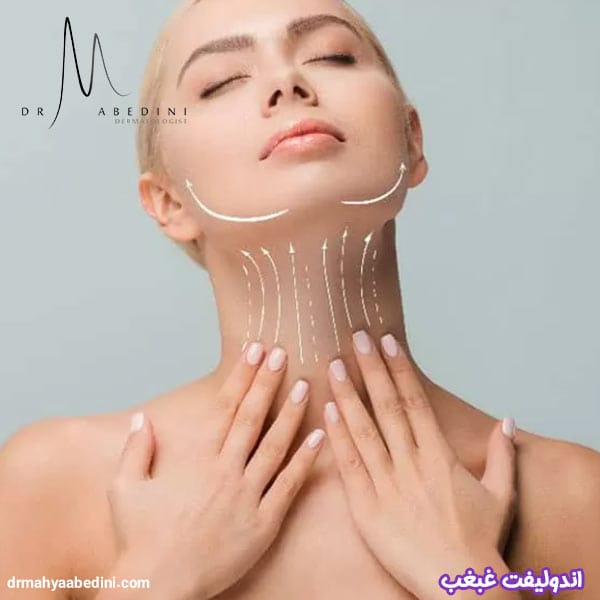 اندولیفت غبغب