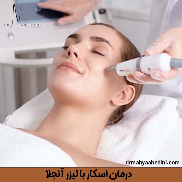 درمان اسکار با لیزر آنجلا