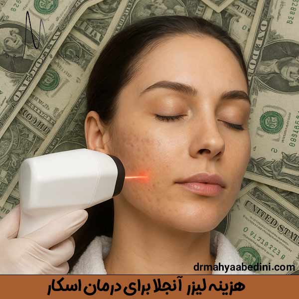 هزینه لیزر آنجلا برای درمان اسکار - دکتر محیا عابدینی