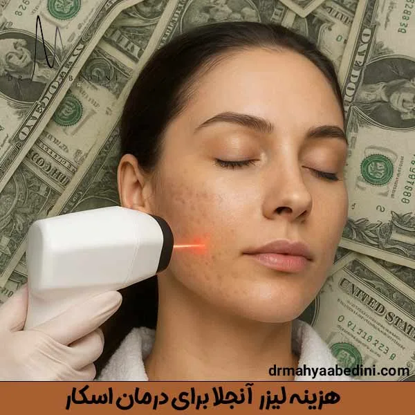 هزینه لیزر آنجلا برای درمان اسکار - دکتر محیا عابدینی